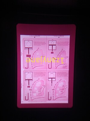 F02 VINTAGE Photo 35mm Slide HUMAN LUNG FUNCTION DIAGRAM