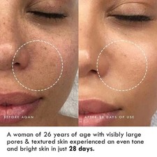 Whitening Dark spot Brightening Bleaching Lightening Face Cream - 50gm