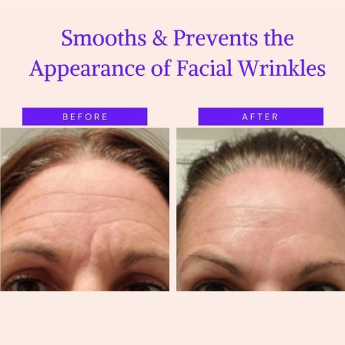 144pcs Facial Smoothies TRIANGLE Wrinkle Patches - Anti-Aging Forehead Smooth UK - Picture 8 of 14