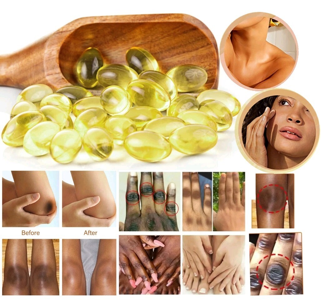 Gélules éclaircissantes au glutathione et collagène pour estomper les taches brunes