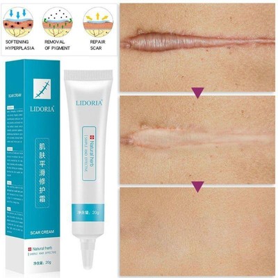 skin repair scar cream