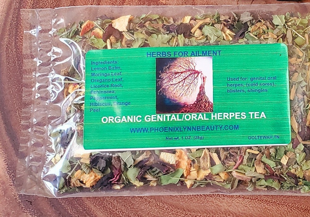 Genital/Oral Herpes Herbal Blend Tea- All Natural 2 variations