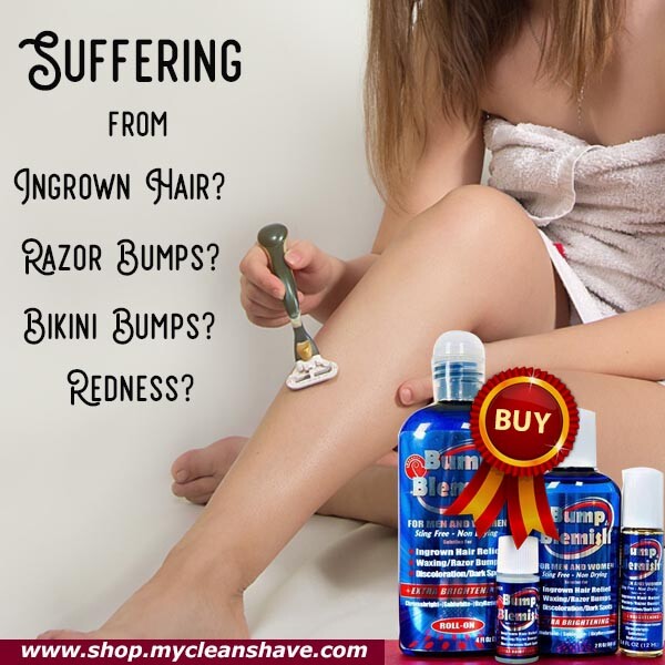 Bump And Blemish Guaranteed Solution For Ingrown Hair 2oz Razor
