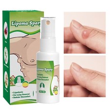 1Pieces Lipomheilung Reduction Spray, 1 Fl Oz LumpFree Lipoma Removal Spray