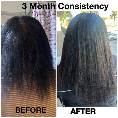 4 Step Hair Growth System Bundle for Thicker Fuller Hair in Weeks