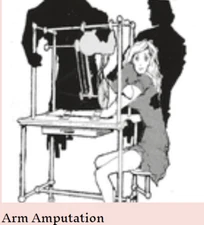 ARM AMPUTATION - ILLUSION BUILDING PLANS -  OSBORNE