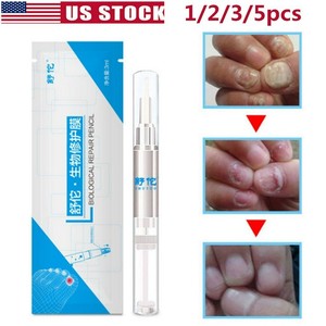 3ml biological nail repair pencil solution anti fongique infection nail 5/3 x Leuconychia Biological Repair Pencil Herbal Nail Anti Fungal