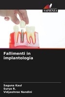 Saguna Kaul (U. A.) | Fallimenti In Implantologia | Taschenbuch | Italienisch
