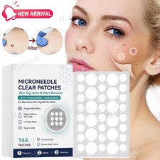 Microneedle Patches 144Pcs Hydrocolloid Cover for Acne Skin Tag Wart Skin Care