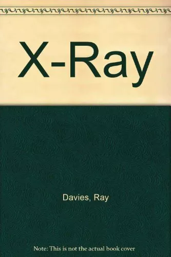 X-Ray: The Unauthorized Autobiography by Ray Davies