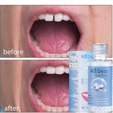 Teeth Strong Tooth Repair Temporary Dental Cement Cavity Filling Kit Fake Teeth