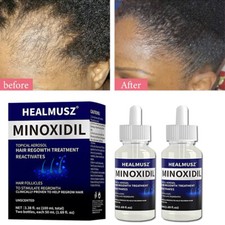 2-10Pack Minoxidil 5 Extra Strength Men Hair Regrowth Solution 6 Month Supply