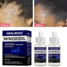 2-10Pack Minoxidil 5% Extra Strength Men Hair Regrowth Solution 6 Month Supply