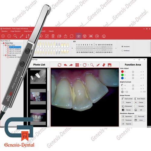 Dental Intraoral Camera + Software included. HighResolution Images