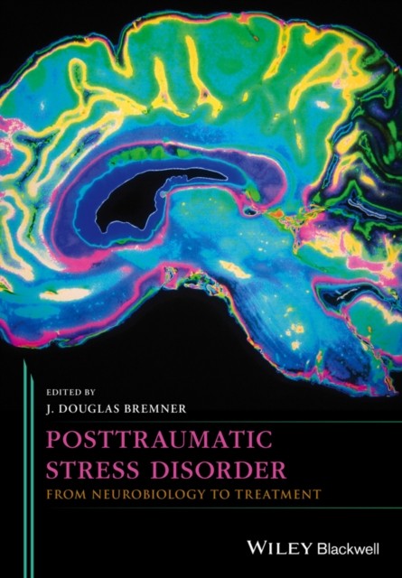 Posttraumatic Stress Disorder – From Neurobiology to Treatment Bremner Hardback