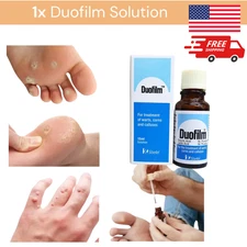 DUOFILM Solution Treatment Remove Warts Corns Calluses with Salicylic Acid 15ml