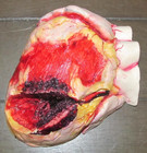 Anatomical Human Heart Brain Model Medical Teaching Patient Counseling Resin — photo 4