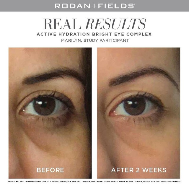 rodan and fields eye complex
