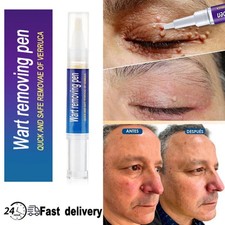 5ml Skin Tag Remover Pen Skin Tag Mole Wart Dark Spot Remover Painless  Safe