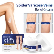 1-5X Varicose Veins Treatment for Legs, Improve Blood Circulation  Smooth Skin