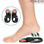 miniatuur 4  - Pedimend O/X Type Leg Orthopedic Insole (1PAIR) - Feet Corrective Pads - UK