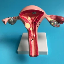 New Human Pathological Uterus Ovary Model Cross Section Structure Model Uterus