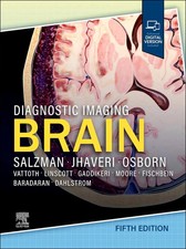Diagnostic Imaging: Brain, | Karen L Salzman ...