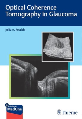 Optical Coherence Tomography in Glaucoma | Jullia Rosdahl | Englisch | Bundle