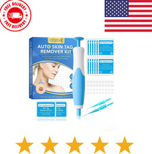 Auto Micro Skin Tag Remover Device Kit Safe Painless Removal 2-8 mm Band Tool