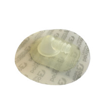 XL Self Stick One Pump Ventil Spleene Wainman Royal kite Bladder repair