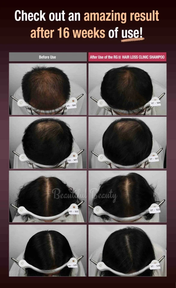 RGIII RG3 PREMIUM 2 X профилактики выпадения волос клиника шампунь / лечение красный женьшень - Изображение 4 из 4