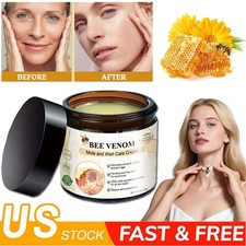 Bee Venom Skin Tag Removal Treatment Cream Body Care Mole Corn Wart Remover