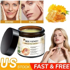 Bee Venom Skin Tag Removal Treatment Cream Body Care Mole Corn Wart Remover 