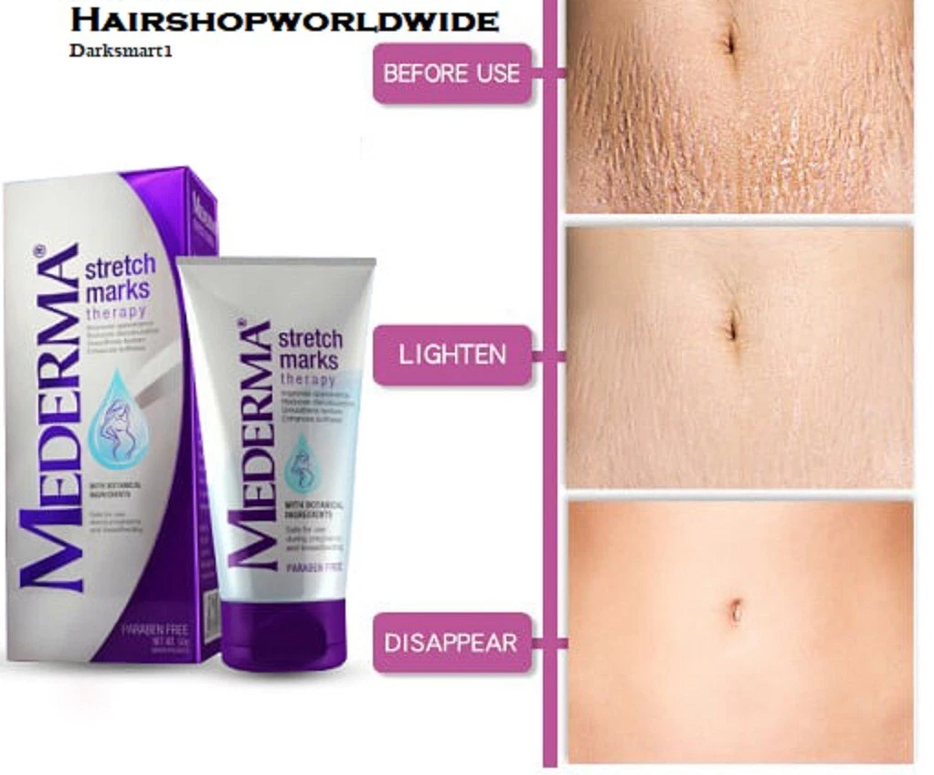 Mederma Stretch Marks Therapy 25g pregnancy marks reducer eBay