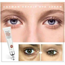 Magic Eye Cream 28 seconds remove eye bags dark circles eye wrinkles Anti Aging