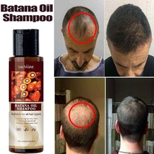 100ml Batana Oil Hair Growth Shampoo, Anti Hair Loss Shampoo Repair Damage Hair