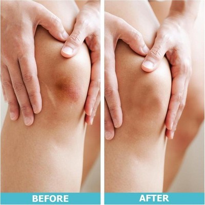 Hydrocolloid Self Adhesive Dressing Roll Wound Dressing Sterile Thin Healing Pad