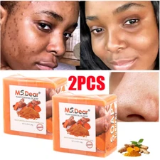 2X Tumeric Soap Acne Dark Spots Removal Skin Whitening Body Bleaching Bath Soap