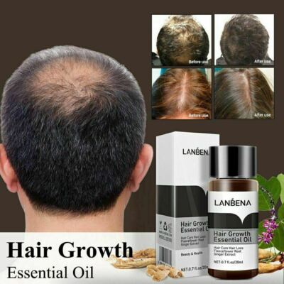 Lanbena Ginger Extract Hair Care Fast Powerful Hair Growth Essential Oil 20ml