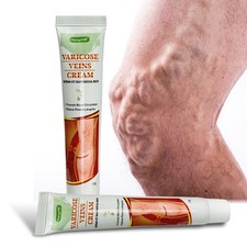 Ointment Varicose Veins Vasculitis Support Cream Legs Foot Spider Pain 20 mg