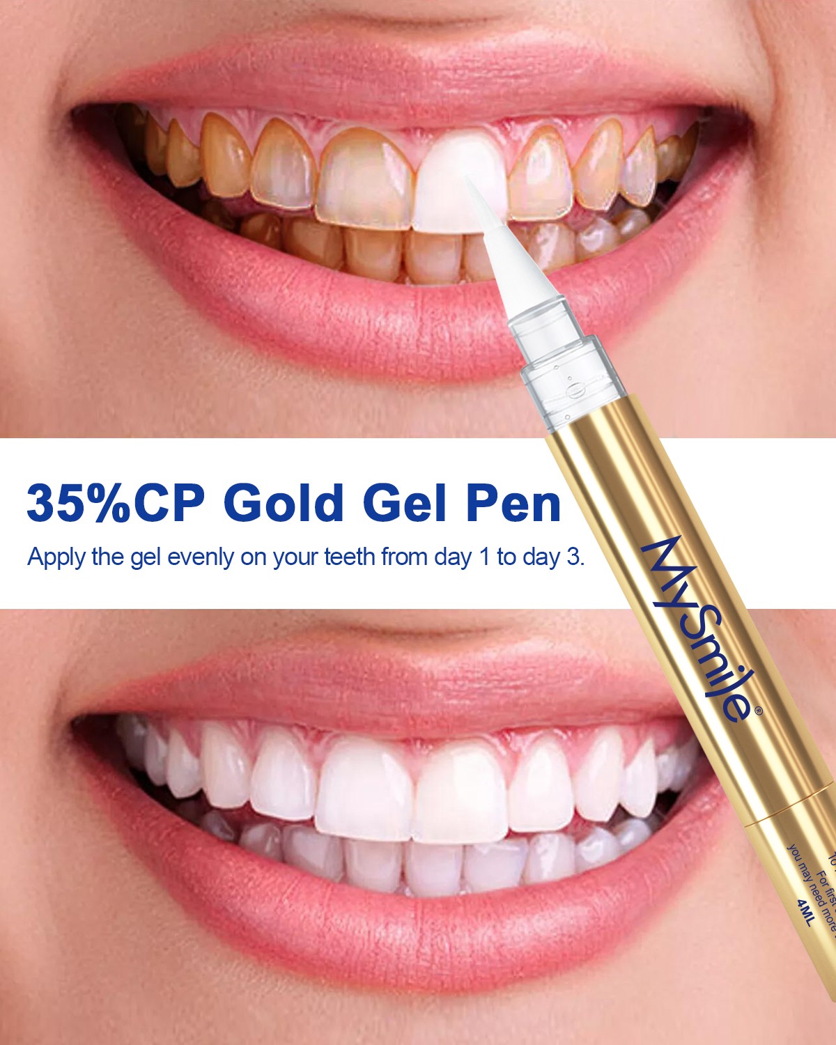 MySmile 35%CP Teeth Whitening Pen Kit 4 Gold Whitener Pen with 28-LED Light Tray