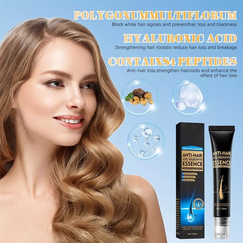 Zozu Suero Anti-PĂ©rdida de Cabello Crecimiento del Cabello-Suero de Crecimiento del Cabello, Suero de Aceite de Crecimiento del Cabellođ„ - Imagen 6 de 7