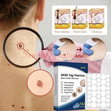 Skin Tag Remover Patches Quick Effective Mole and Wart Pad Removal Sticker US