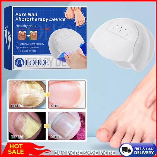 Nail Fungus Cleaning Device Home Use Nail-Fungus Remover for Onychomycosis