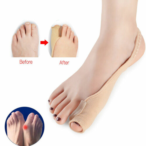 PEDIMEND™ 1X Hallux Valgus Pro Toe Separator - For Big Toe Joint Pain Treatment - Afbeelding 1 van 7