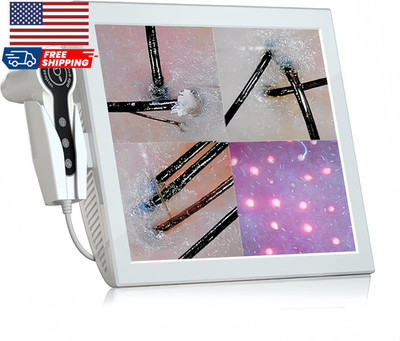 Professional 15-Inch Scalp Camera for Beauty Salons High-Resolution Hair NEW