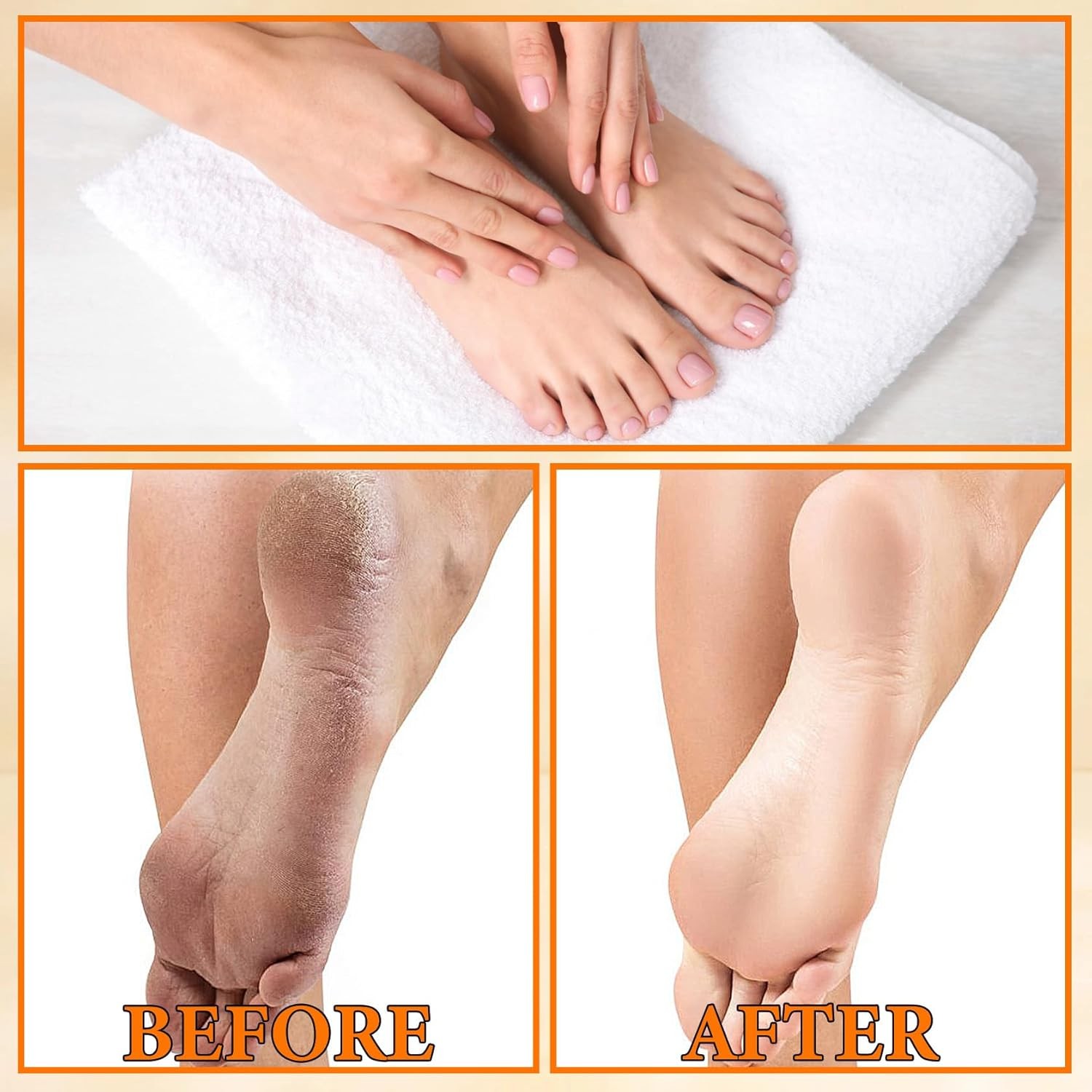 6PCS Foot Peel Mask,Exfoliating Mask for Remove Dead Skin,Hydrating 6P 