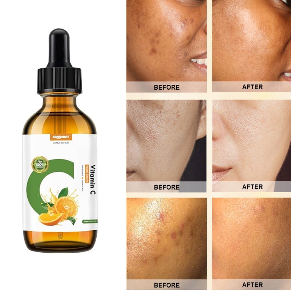 100% Pure Vitamin C Serum with Hyaluronic Acid for Anti-Aging 1 oz