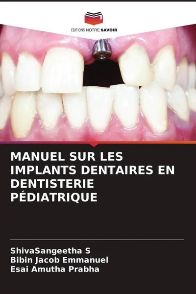 Shivasangeetha S (U. A.) | Manuel SUR LES Implants Dentaires EN Dentisterie...-image