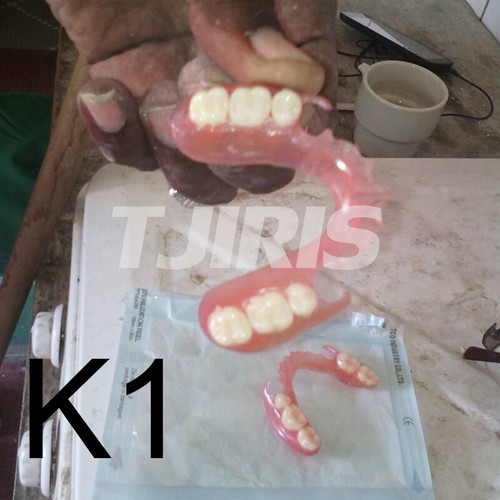500g Dental Valplast Flexibles Acryl Teilmaterial mit simulierter Blutlinie - Bild 22 von 28